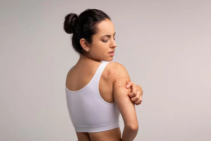 What to know about pimples on the arms